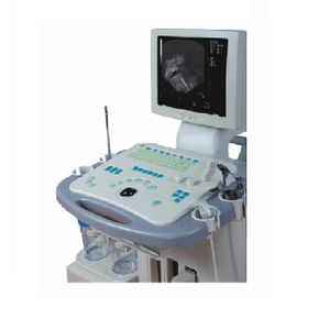 CE/ISO 承認の Gyn 可視超音波診断システム マシン (MT01006081)