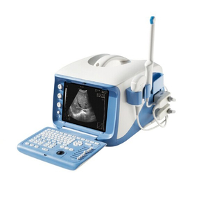 病院のポータブル 4D 超音波診断システム機械 (MT01006101)